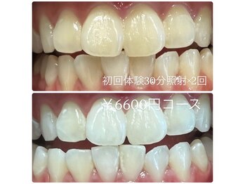 ホワイトニングルーム 川崎店(WhiteningRoom)/ホワイトニング/川崎　