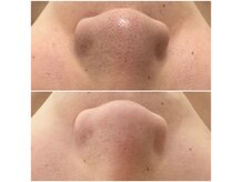 ボヌール 久留米(Bonheur)の雰囲気(効果が分かるサロン/フェイシャルもボディもお任せください◎)