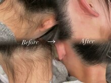 Eyelashsalon Yupis【ユピス】【5月 OPEN（予定）】/うなじWAX