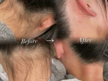 Eyelashsalon Yupis【ユピス】【5月 OPEN(予定)】/うなじWAX