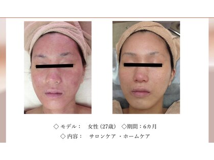 エテル(eter)の写真