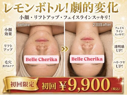 ベルチェリカ(Belle CHERIKA)の写真