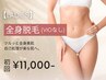 【8月限定特価★レディース脱毛】全身脱毛(VIO無し) 初回13,500円→11,000円