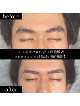 ユー 西船橋店(you)/ビフォーアフター写真