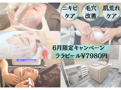あすはれの写真