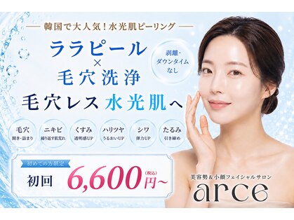 アルセ(arce)の写真