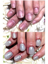 施術前と施術後