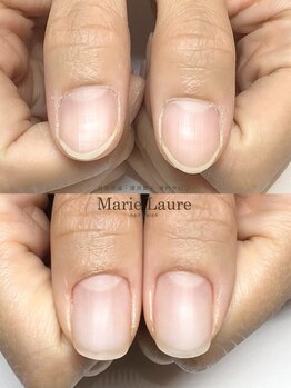 マリーロール 梅田店(Marie Laure)/自爪育成/深爪矯正/ネイルケア