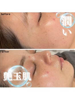 サロンドエテ(salon de ete)/潤い水光艶玉肌