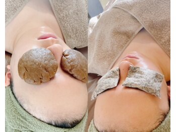 サプナジー(Suppnrgy)/アイポーケア