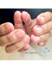 ネイルケアシェラック