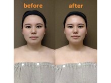 ドクタージェーナ(Dr.Jena)/お客様before/afterお客様bef