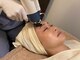 ルルド(luludo)の写真/先進美容"水光ジェット"で毛穴0宣言! 毛穴ケアはもちろん、ニキビケア・お肌のハリツヤ、たるみ改善を実現!