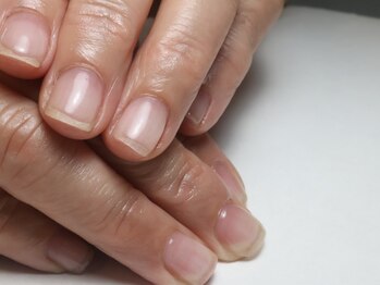 クロ(KURO)/自爪育成/柳津ネイルサロン