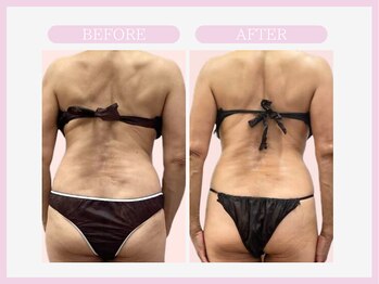 スリムライン 山形店(The Slim Line)/before→after