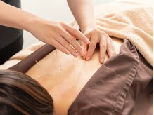 つつじが丘整骨院鍼灸マッサージ院/鍼灸施術