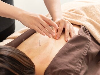 つつじが丘整骨院鍼灸マッサージ院/鍼灸施術