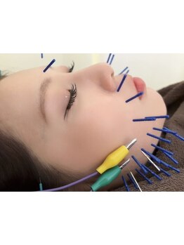 小顔になりたい