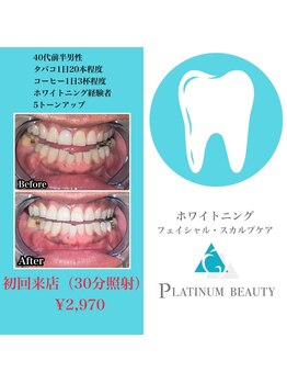プラチナムビューティ 渋谷店(PLATINUM Beauty)/セルフホワイトニング