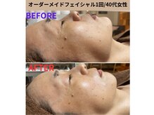 コルッソ(CoLusson.)/オーダーメイドフェイシャル９０