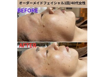 コルッソ(CoLusson.)/オーダーメイドフェイシャル90