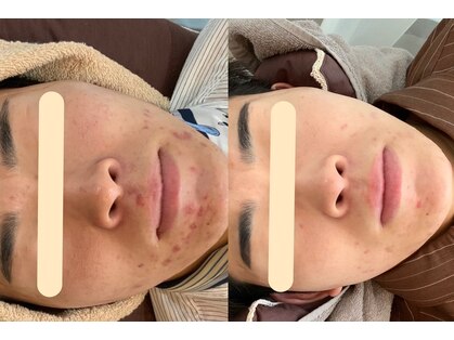 エスポワール(espoir)の写真