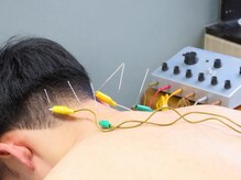 渋谷中医メディカル鍼灸院/施術風景