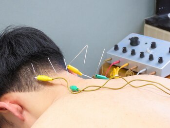 渋谷中医メディカル鍼灸院/施術風景