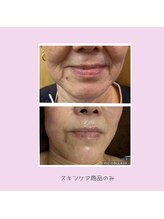 レジュイール(Rejouir)/いくつになっても綺麗でいたい！