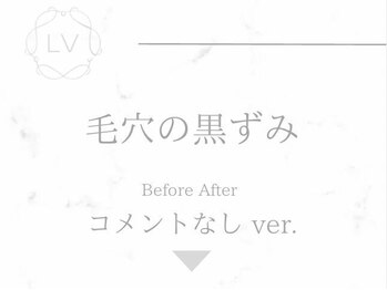 ラヴィオーラ 名駅(LV)/ダイヤモンドハーブピーリング