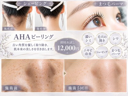 クラリス(Clarice)の写真