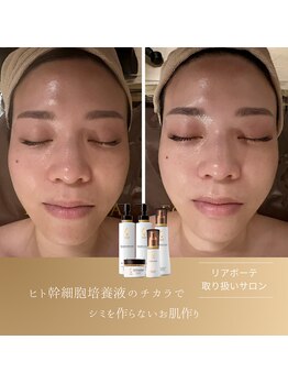 サロンシー(salon C)の写真/【根深いお肌悩み!悩みを作らないお肌作りへ】7種のヒト幹細胞培養液配合☆マーメイドセルトリートメント
