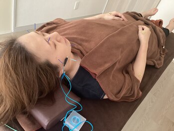 ハリファ鍼灸院 横浜関内院(HariFa鍼灸院)/美容施術