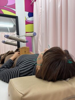 ことぶき整骨院/美容鍼