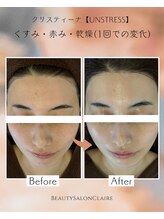 クレール(Claire)/【アンストレス】くすみ/赤み