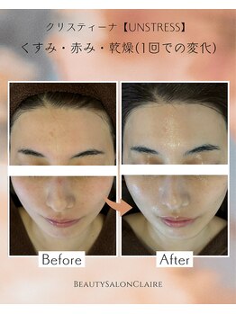 クレール(Claire)/【アンストレス】くすみ/赤み