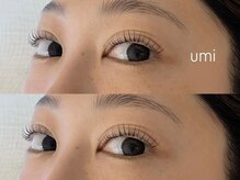 ウミ(umi)