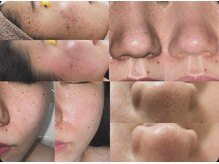 プリマ 栄店(Prima)の雰囲気（美肌力をあげるならPrimaにお任せ！透明感溢れるツヤ肌へ）