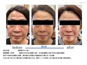 ミラー(MIRROR)/フェイシャル/40代/50代