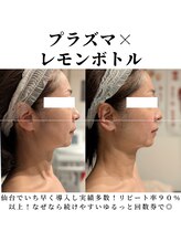 トリニティスペース(TrinitySpace)/レモンボトルビフォーアフター