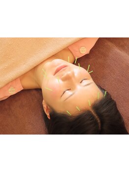 鍼灸施術を受けたい