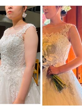 ルリール(Le Rire)/ブライダルエステ