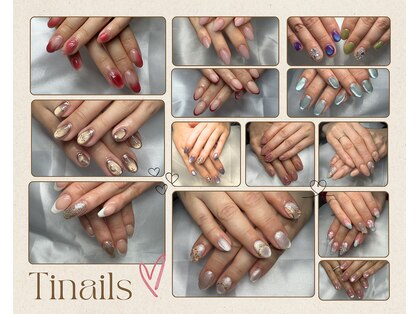 ティネイル(Tinails)の写真