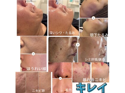 ミライ(Mirai)の写真