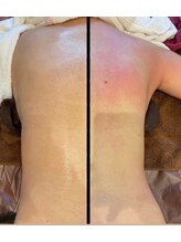 ルナグランデ(Luna grande.)/キャビリポ効果絶大！