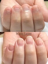 マリーロール 梅田店(Marie Laure)/自爪育成/深爪矯正/ネイルケア