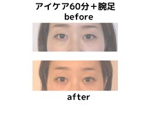 ウル(Ulu)の雰囲気（何ヶ月もとれなかった目の奥の痛みも和らぎ、目がパッチリ！）