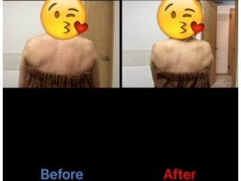 ガネェーシャ(Ganesha)/凝り固まった背中を解消