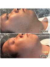 シンバ 倉敷店(SIMBA)/