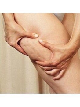 横浜自然堂 美骨サロンの写真/《下半身の脂肪を集中分解☆加齢によるたるみを改善》諦めていた凹凸セル脂肪を徹底燃焼！癒し効果も♪